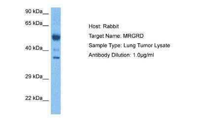 Western Blot: MRGPRD Antibody [NBP2-87820]