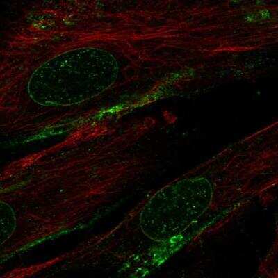 Immunocytochemistry/ Immunofluorescence: MRGPRF Antibody [NBP1-83341]