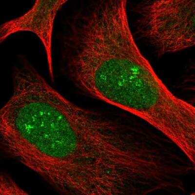 Immunocytochemistry/ Immunofluorescence: MRLC2 Antibody [NBP2-54719]