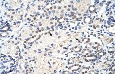 Immunohistochemistry-Paraffin: MRM1 Antibody [NBP1-57367]