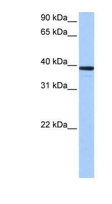Western Blot: MRM1 Antibody [NBP1-57366]