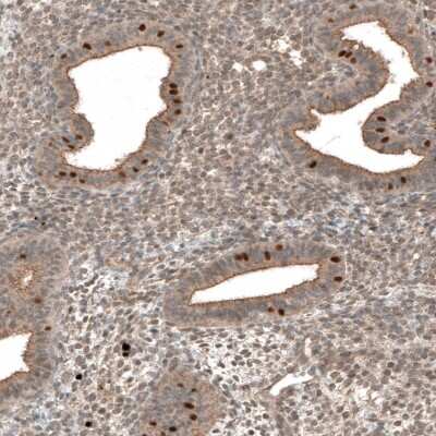 Immunohistochemistry-Paraffin: MRN Complex Interacting Protein Antibody [NBP2-14417]