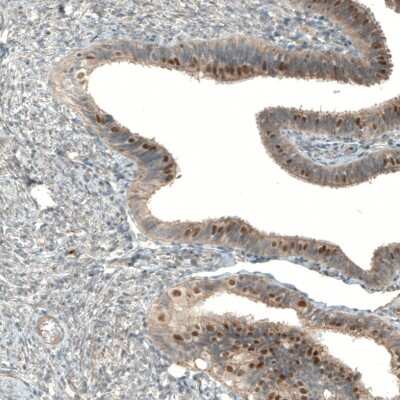Immunohistochemistry-Paraffin: MRN Complex Interacting Protein Antibody [NBP2-14417]