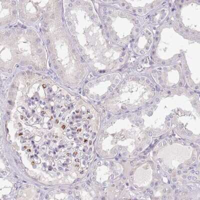 Immunohistochemistry-Paraffin: MRO Antibody [NBP2-13608]