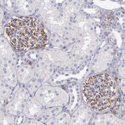Immunohistochemistry-Paraffin: MRP1 Antibody [NBP3-05508]