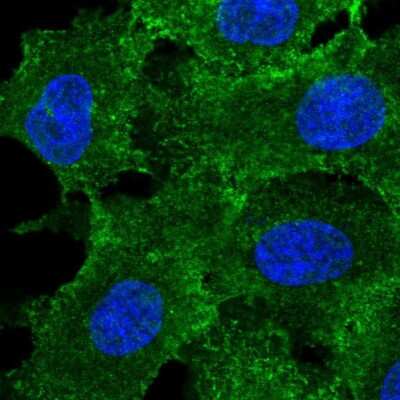 Immunocytochemistry/ Immunofluorescence: MRP3 Antibody [NBP2-37923]