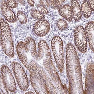Immunohistochemistry-Paraffin: MRP3 Antibody [NBP2-37923]