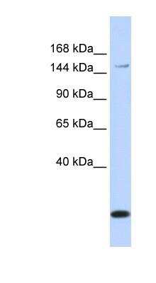 Western Blot: MRP3 Antibody [NBP1-59806]
