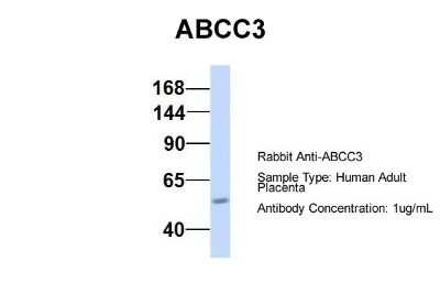 Western Blot: MRP3 Antibody [NBP1-59806]