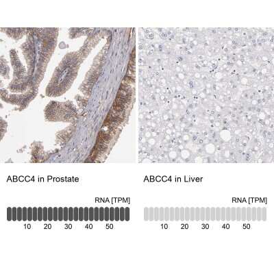 Immunohistochemistry-Paraffin: MRP4/ABCC4 Antibody [NBP1-84782]