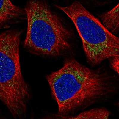 Immunocytochemistry/ Immunofluorescence: MRP63 Antibody [NBP2-57237]