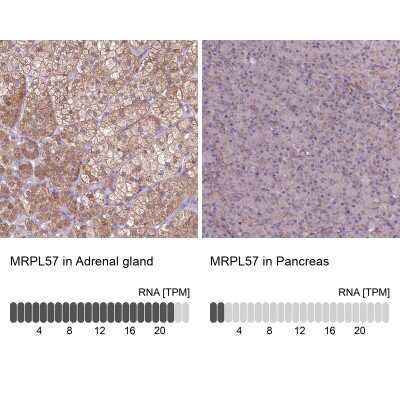 Immunohistochemistry-Paraffin: MRP63 Antibody [NBP1-90898]
