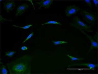 Immunocytochemistry/ Immunofluorescence: MRPL1 Antibody (2C4) [H00065008-M02]