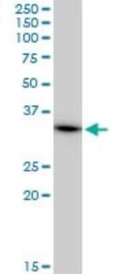 Western Blot: MRPL1 Antibody (2C4) [H00065008-M02]