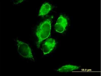 Immunocytochemistry/ Immunofluorescence: MRPL1 Antibody [H00065008-B01P]