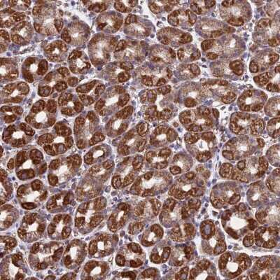 Immunohistochemistry-Paraffin: MRPL1 Antibody [NBP2-13609]