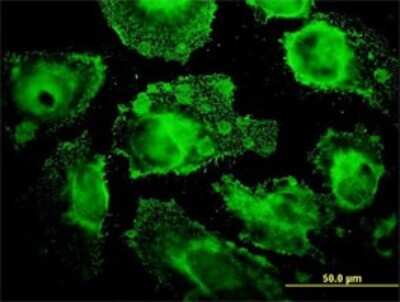 Immunocytochemistry/ Immunofluorescence: MRPL12 Antibody (3B12-1A3) [H00006182-M01]