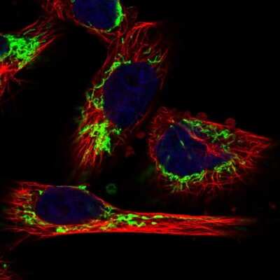 Immunocytochemistry/ Immunofluorescence: MRPL12 Antibody [NBP1-85216]