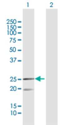 Western Blot: MRPL12 Antibody [H00006182-D01P]