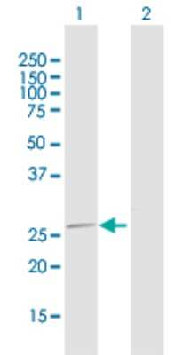 Western Blot: MRPL16 Antibody [H00054948-D01P]