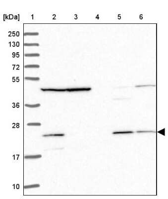 Western Blot: MRPL17 Antibody [NBP2-13611]