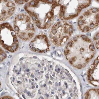 Immunohistochemistry-Paraffin: MRPL18 Antibody [NBP1-83176]