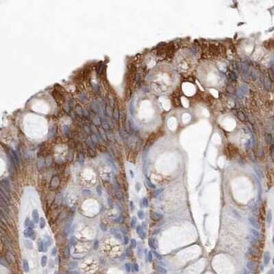 Immunohistochemistry-Paraffin: MRPL18 Antibody [NBP1-83177]
