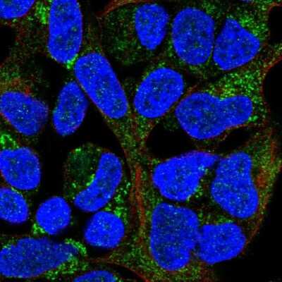 Immunocytochemistry/ Immunofluorescence: MRPL20 Antibody [NBP1-92138]