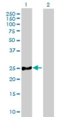 Western Blot: MRPL21 Antibody [H00219927-B01P]