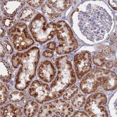 Immunohistochemistry-Paraffin: MRPL22 Antibody [NBP2-30482]