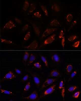Immunocytochemistry/ Immunofluorescence: MRPL23 Antibody - Azide and BSA Free [NBP2-94112]