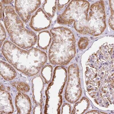 Immunohistochemistry: MRPL24 Antibody [NBP2-68709]