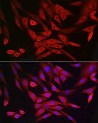 Immunocytochemistry/ Immunofluorescence: MRPL28 Antibody (3B9F2) [NBP3-15267]