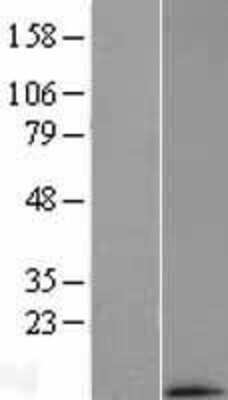 Western Blot: MRPL33 Overexpression Lysate [NBL1-13257]