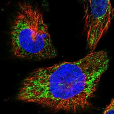 Immunocytochemistry/ Immunofluorescence: MRPL38 Antibody [NBP1-81672]