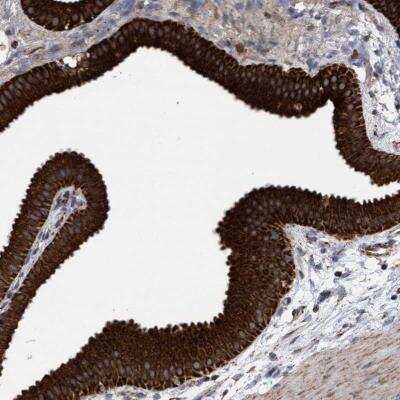 Immunohistochemistry: MRPL38 Antibody [NBP1-81672]