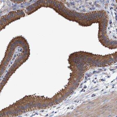 Immunohistochemistry: MRPL38 Antibody [NBP1-81673]
