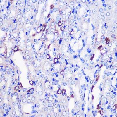Immunohistochemistry-Paraffin: MRPL38 Antibody - Azide and BSA Free [NBP2-93579]