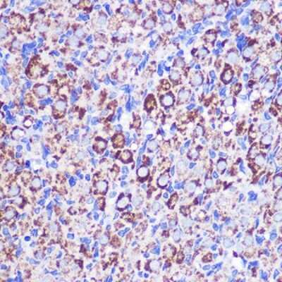 Immunohistochemistry-Paraffin: MRPL38 Antibody - Azide and BSA Free [NBP2-93579]