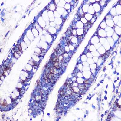 Immunohistochemistry-Paraffin: MRPL38 Antibody - Azide and BSA Free [NBP2-93579]