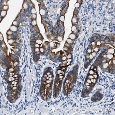 Immunohistochemistry-Paraffin: MRPL39 Antibody [NBP1-86815]