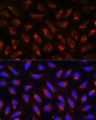 Immunocytochemistry/ Immunofluorescence: MRPL43 Antibody - Azide and BSA Free [NBP2-93527]