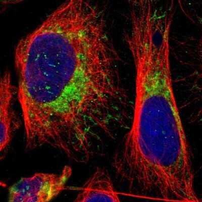 Immunocytochemistry/ Immunofluorescence: MRPL45 Antibody [NBP1-82763]