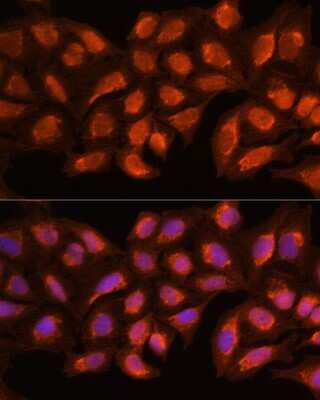 Immunocytochemistry/ Immunofluorescence: MRPL45 Antibody - Azide and BSA Free [NBP2-93711]