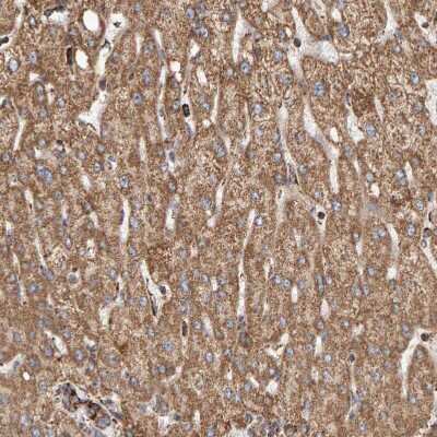 Immunohistochemistry-Paraffin: MRPL45 Antibody [NBP1-82764]