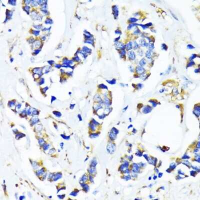Immunohistochemistry-Paraffin: MRPL45 Antibody - Azide and BSA Free [NBP2-93711]
