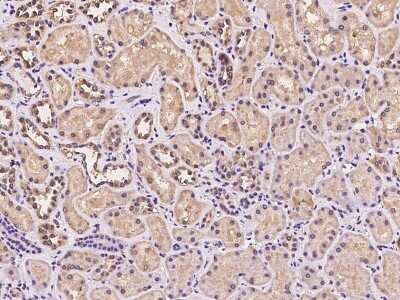 Immunohistochemistry-Paraffin: MRPL45 Antibody [NBP2-97306]