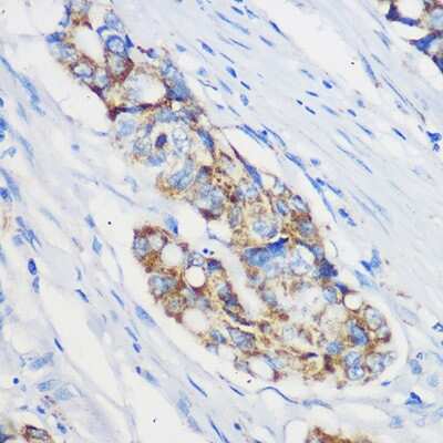 Immunohistochemistry-Paraffin: MRPL46 Antibody - Azide and BSA Free [NBP2-94483]