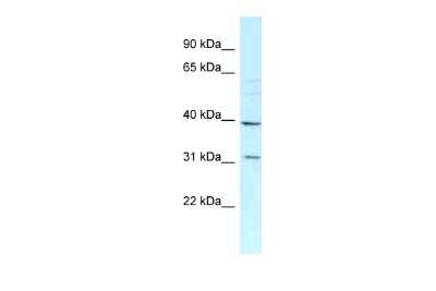 Western Blot: MRPL46 Antibody [NBP2-85320]