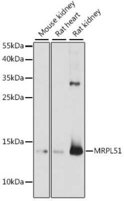 Western Blot: MRPL51 AntibodyAzide and BSA Free [NBP2-94233]